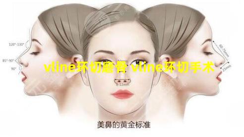 vline环切磨骨 vline环切手术